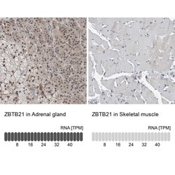Invitrogen ZNF295 Polyclonal Antibody 100 &mu;L; Unconjugated:Antibodies,