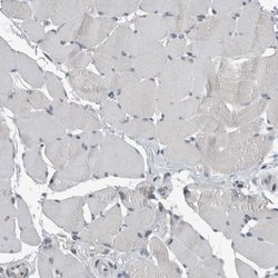 Invitrogen ZNF295 Polyclonal Antibody 100 &mu;L; Unconjugated:Antibodies,