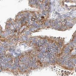 Invitrogen BZRAP1 Polyclonal Antibody 100 &mu;L; Unconjugated:Antibodies,
