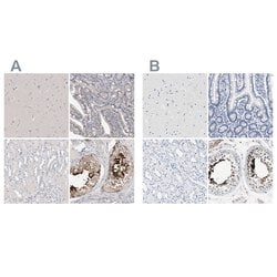 Invitrogen Actin-like 7B Polyclonal Antibody 100 &mu;L; Unconjugated:Antibodies,