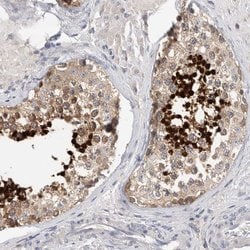 Invitrogen Actin-like 7B Polyclonal Antibody 100 &mu;L; Unconjugated:Antibodies,