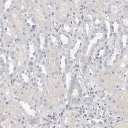 Invitrogen Actin-like 7B Polyclonal Antibody 100 &mu;L; Unconjugated:Antibodies,