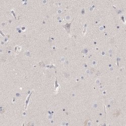 Invitrogen Actin-like 7B Polyclonal Antibody 100 &mu;L; Unconjugated:Antibodies,