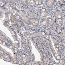 Invitrogen Actin-like 7B Polyclonal Antibody 100 &mu;L; Unconjugated:Antibodies,