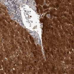 Invitrogen RHPN1 Polyclonal Antibody 100 &mu;L; Unconjugated:Antibodies,