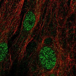 KIAA1456 Polyclonal Antibody:Antibodies, Polyclonal