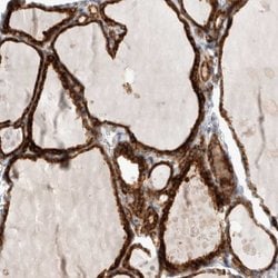 KIAA1456 Polyclonal Antibody:Antibodies, Polyclonal