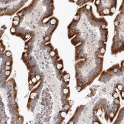 KIAA1456 Polyclonal Antibody:Antibodies, Polyclonal
