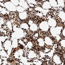 Invitrogen ID3 Polyclonal Antibody 100 &mu;L; Unconjugated:Anticorps, Polyclonal