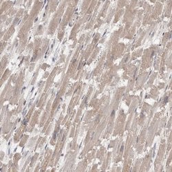 Invitrogen FHOD3 Polyclonal Antibody 100 μL; Unconjugated:Antibodies,
