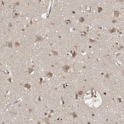 Invitrogen FHOD3 Polyclonal Antibody 100 μL; Unconjugated:Antibodies,