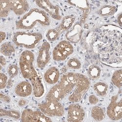 Invitrogen FHOD3 Polyclonal Antibody 100 μL; Unconjugated:Antibodies,