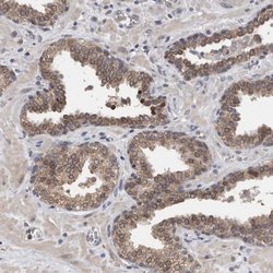 Invitrogen FHOD3 Polyclonal Antibody 100 μL; Unconjugated:Antibodies,