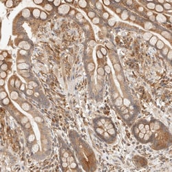 Invitrogen TACC1 Polyclonal Antibody 100 &mu;L; Unconjugated:Antibodies,