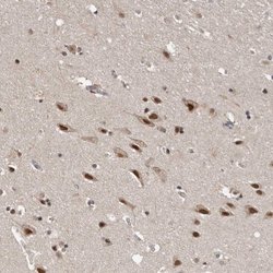 Invitrogen VPS37A Polyclonal Antibody 100 &mu;L | Buy Online | Invitrogen&trade; | Fisher Scientific