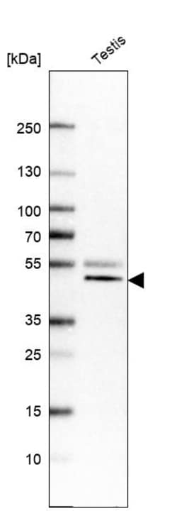 Invitrogen VPS37A Polyclonal Antibody 100 &mu;L | Buy Online | Invitrogen&trade; | Fisher Scientific