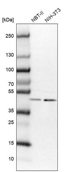 Invitrogen VPS37A Polyclonal Antibody 100 &mu;L | Buy Online | Invitrogen&trade; | Fisher Scientific