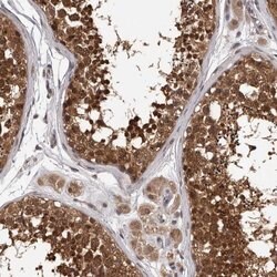 Invitrogen VPS37A Polyclonal Antibody 100 &mu;L | Buy Online | Invitrogen&trade; | Fisher Scientific