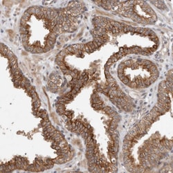 Invitrogen CRISPLD1 Polyclonal Antibody 100 &mu;L; Unconjugated:Antibodies,
