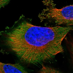 Invitrogen CGI-62 Polyclonal Antibody 100 &mu;L; Unconjugated:Antibodies,