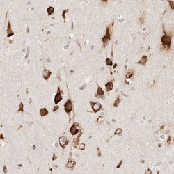 Invitrogen CGI-62 Polyclonal Antibody 100 &mu;L; Unconjugated:Antibodies,