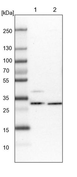 Invitrogen CGI-62 Polyclonal Antibody 100 &mu;L; Unconjugated:Antibodies,