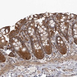 Invitrogen SNX16 Polyclonal Antibody 100 &mu;L; Unconjugated:Antibodies,