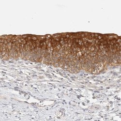 Invitrogen SH3GLB2 Polyclonal Antibody 100 &mu;L; Unconjugated:Antibodies,