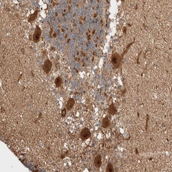 Invitrogen ZNF695 Polyclonal Antibody 100 &mu;L; Unconjugated:Antibodies,