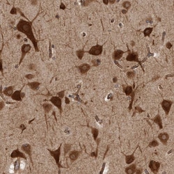 Invitrogen HOOK3 Polyclonal Antibody 100 &mu;L; Unconjugated:Antibodies,