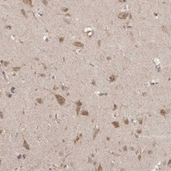 Invitrogen MICU3 Polyclonal Antibody 100 &mu;L; Unconjugated:Antibodies,