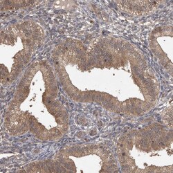 Invitrogen MICU3 Polyclonal Antibody 100 &mu;L; Unconjugated:Antibodies,