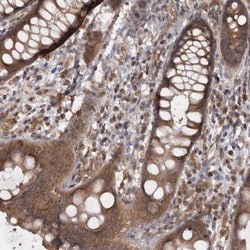 Invitrogen MICU3 Polyclonal Antibody 100 &mu;L; Unconjugated:Antibodies,