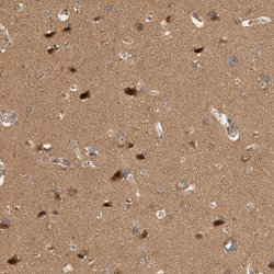 Invitrogen OTUD6B Polyclonal Antibody 100 &mu;L; Unconjugated:Antibodies,