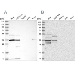 Invitrogen OTUD6B Polyclonal Antibody 100 &mu;L; Unconjugated:Antibodies,