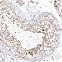 Invitrogen KIF2B Polyclonal Antibody 100 &mu;L; Unconjugated:Antibodies,