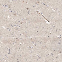 Invitrogen KIF2B Polyclonal Antibody 100 &mu;L; Unconjugated:Antibodies,