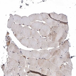 Invitrogen KIF2B Polyclonal Antibody 100 &mu;L; Unconjugated:Antibodies,