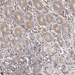 Invitrogen KIF2B Polyclonal Antibody 100 &mu;L; Unconjugated:Antibodies,
