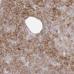 Invitrogen GEM Polyclonal Antibody 100 &mu;L; Unconjugated:Antibodies,