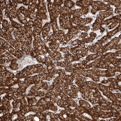 Invitrogen SNX16 Polyclonal Antibody 100 &mu;L; Unconjugated:Antibodies,