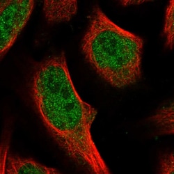 Invitrogen WDYHV1 Polyclonal Antibody 100 &mu;L; Unconjugated:Antibodies,