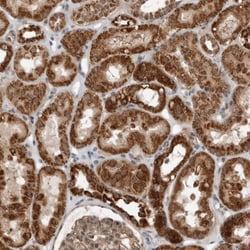 Invitrogen WDYHV1 Polyclonal Antibody 100 &mu;L; Unconjugated:Antibodies,