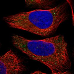 Invitrogen COL22A1 Polyclonal Antibody 100 &mu;L; Unconjugated:Antibodies,