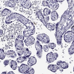 Invitrogen COL22A1 Polyclonal Antibody 100 &mu;L; Unconjugated:Antibodies,