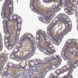 Invitrogen COL22A1 Polyclonal Antibody 100 &mu;L; Unconjugated:Antibodies,