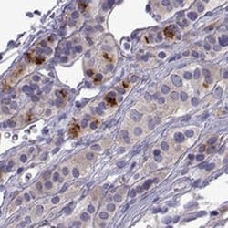 Invitrogen COL22A1 Polyclonal Antibody 100 &mu;L; Unconjugated:Antibodies,