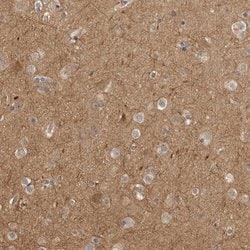 Invitrogen CUEDC1 Polyclonal Antibody 100 &mu;L | Buy Online | Invitrogen&trade; | Fisher Scientific