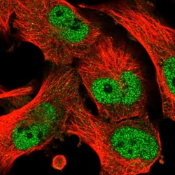 Invitrogen C17orf71 Polyclonal Antibody 100 &mu;L; Unconjugated:Antibodies,