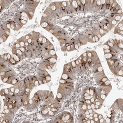 Invitrogen C17orf71 Polyclonal Antibody 100 &mu;L; Unconjugated:Antibodies,